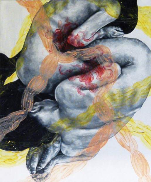 141450msbaumanIntestinal083018 141450msbaumanIntestinal083018