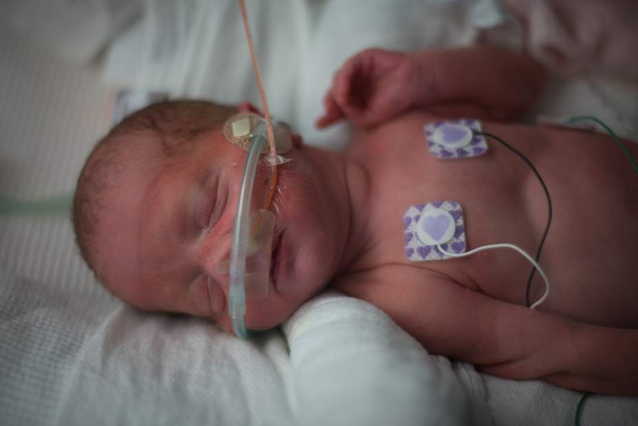 PTRMONOAMNIOTIC03091714