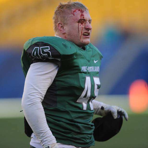 PTRWPIALAAAA01112214