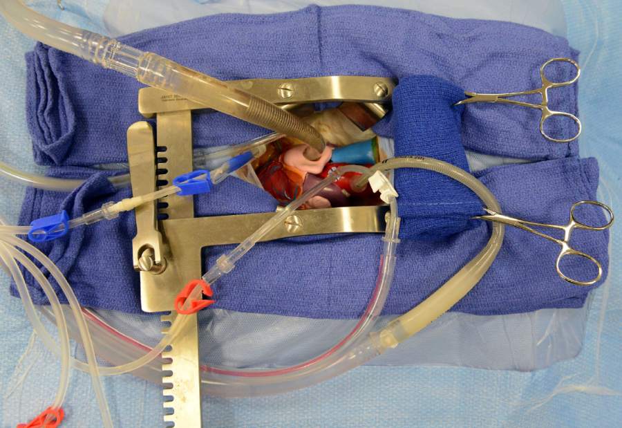 Slide 
													
													2