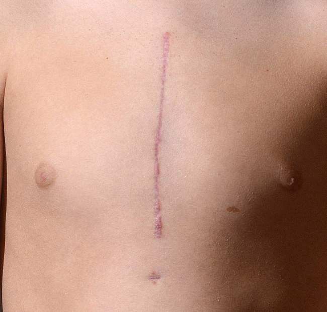 vndheartdefects5020914jpg